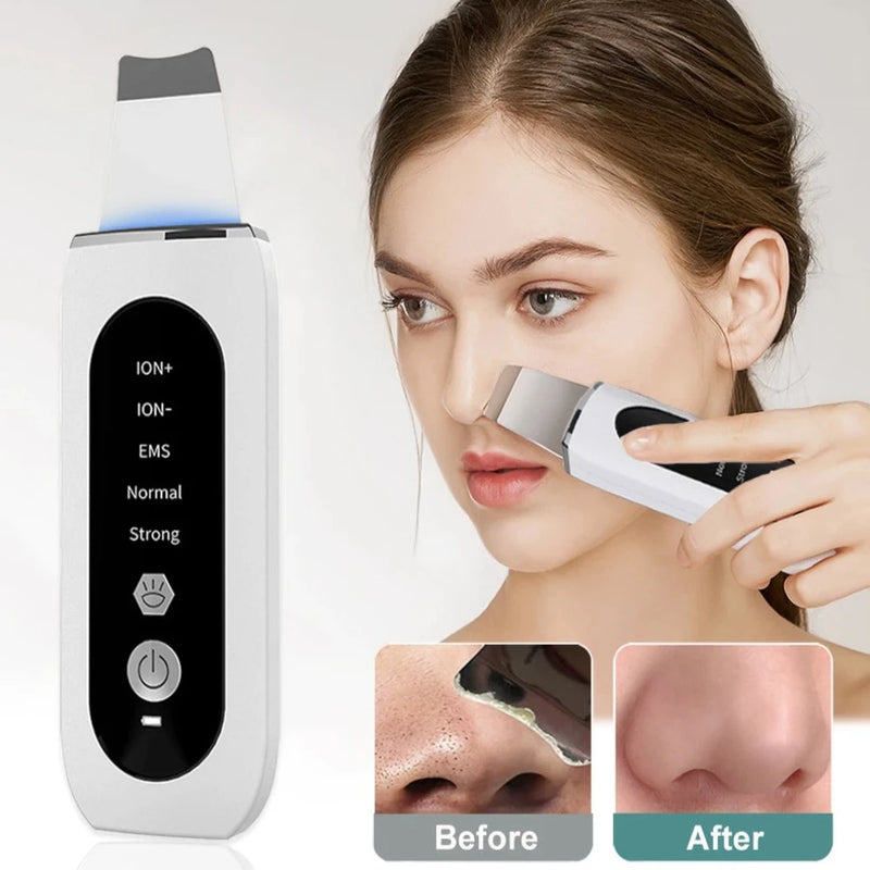 Face Deep Blackhead Remover 