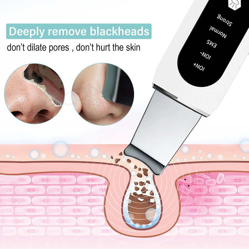 Face Deep Blackhead Remover 